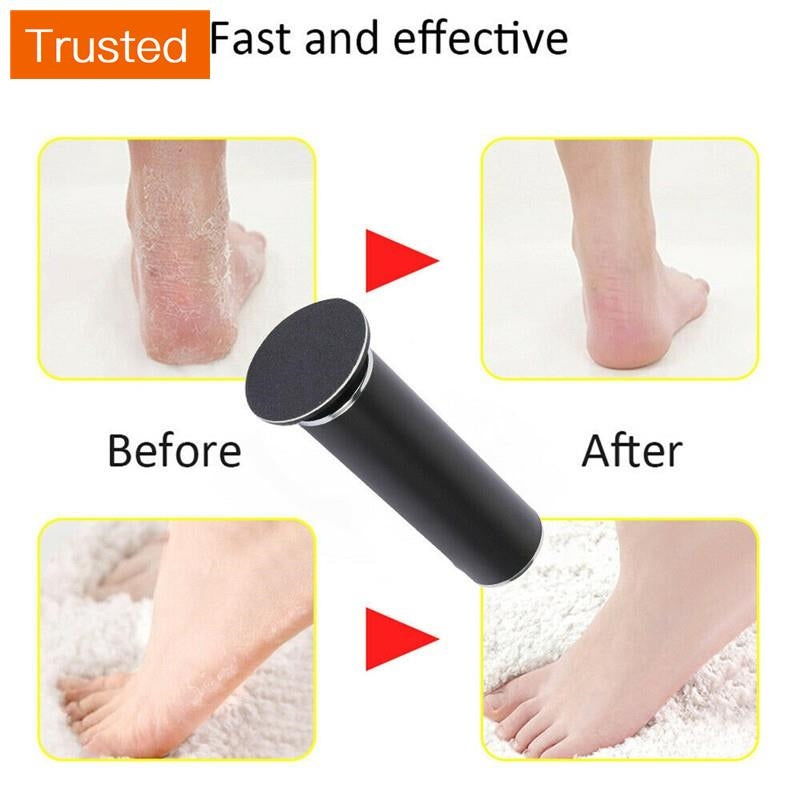 New Electric Foot Dead Skin Grinder Feet Grinding File Callus Remover Pedicure Tool